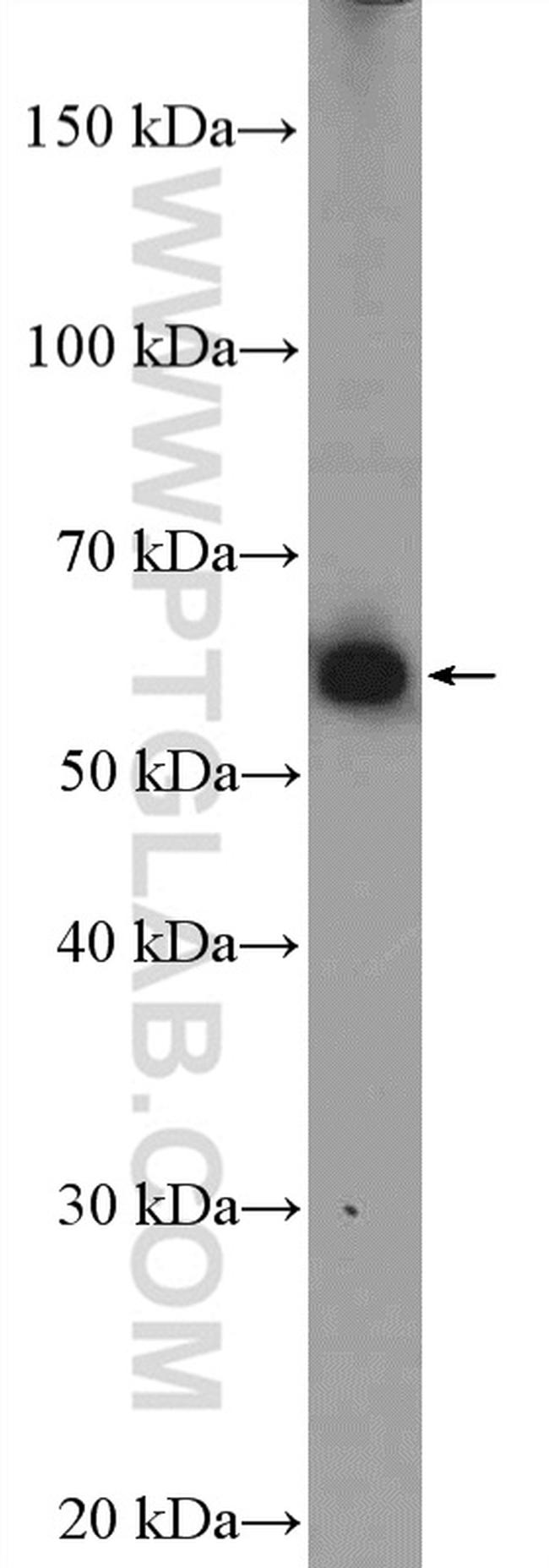 MEF2D Antibody in Western Blot (WB)