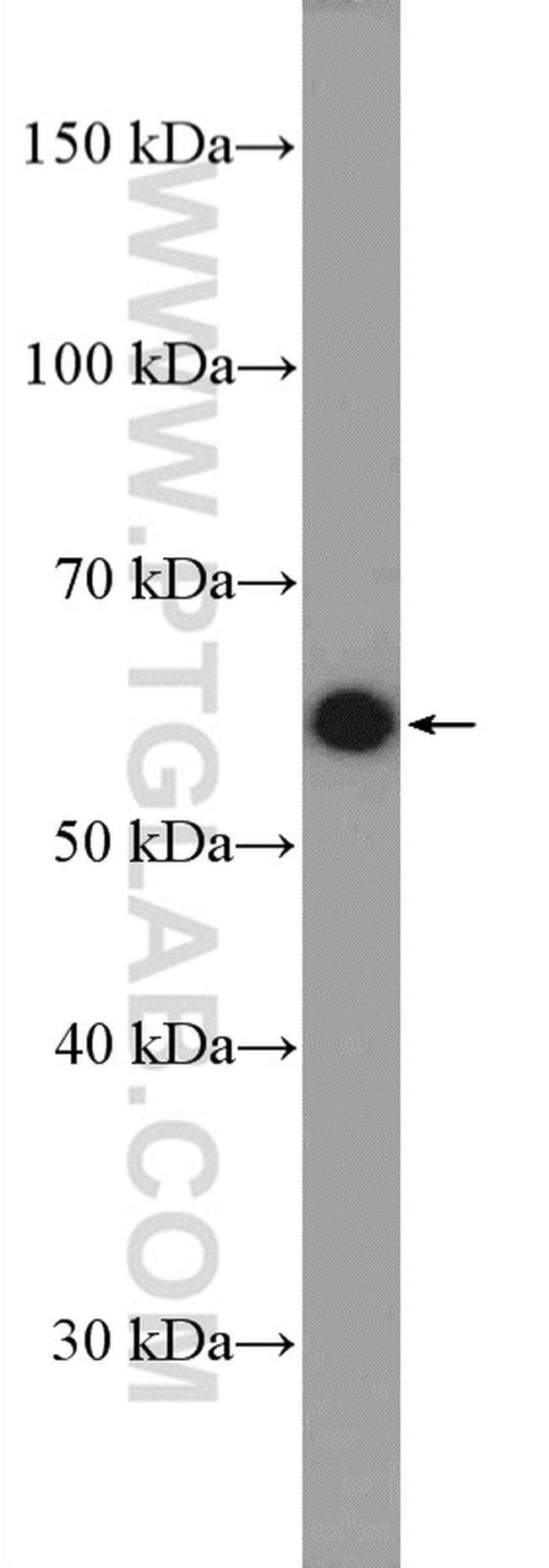 MEF2D Antibody in Western Blot (WB)