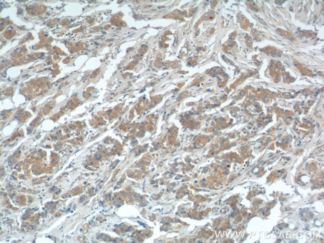 USP15 Antibody in Immunohistochemistry (Paraffin) (IHC (P))