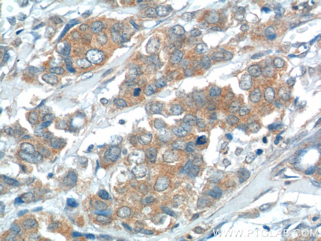 USP15 Antibody in Immunohistochemistry (Paraffin) (IHC (P))