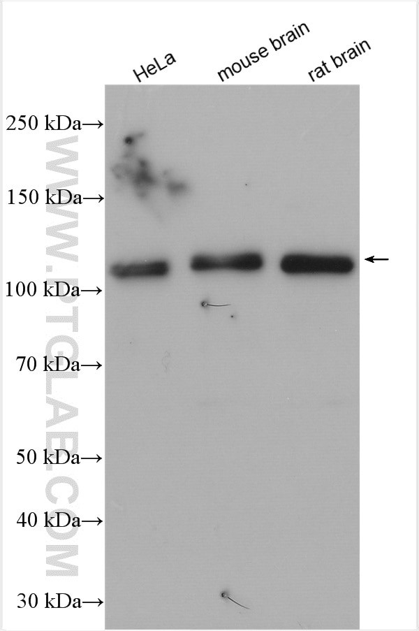 USP15 Antibody in Western Blot (WB)