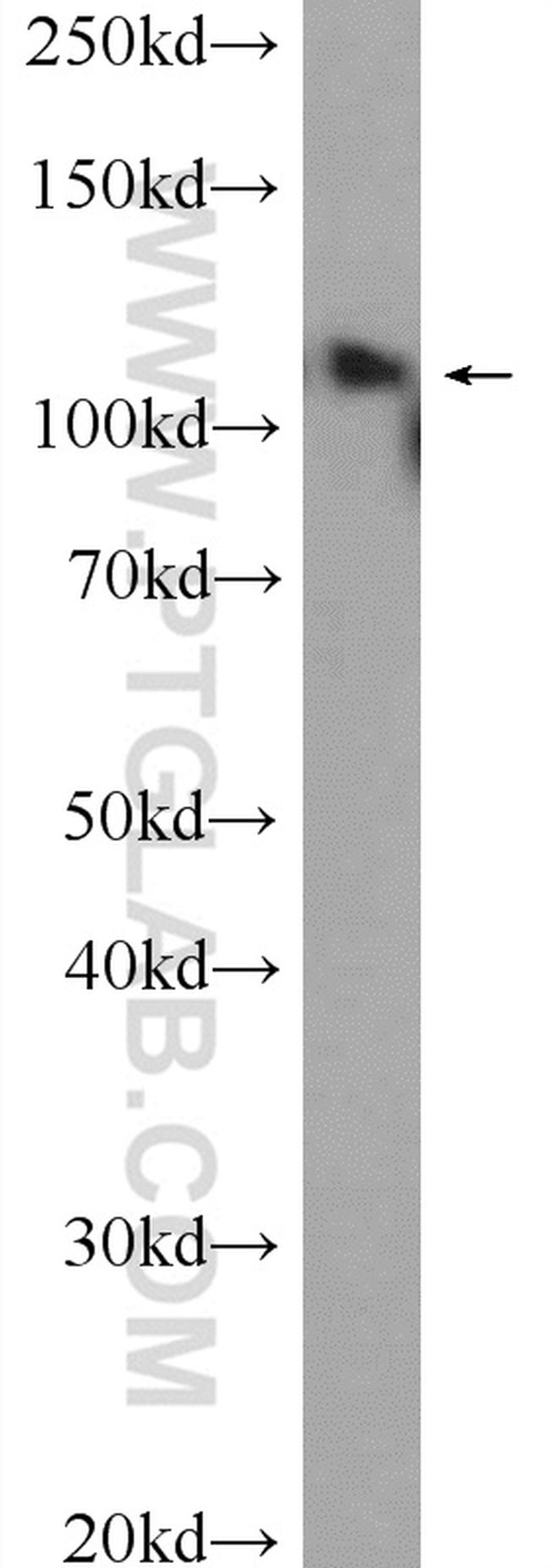 USP15 Antibody in Western Blot (WB)