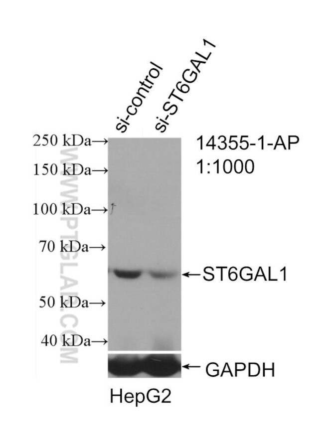 ST6GAL1 Antibody in Western Blot (WB)