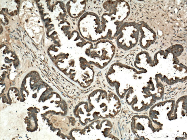 ST6GAL1 Antibody in Immunohistochemistry (Paraffin) (IHC (P))