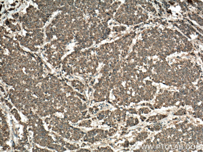 ST6GAL1 Antibody in Immunohistochemistry (Paraffin) (IHC (P))