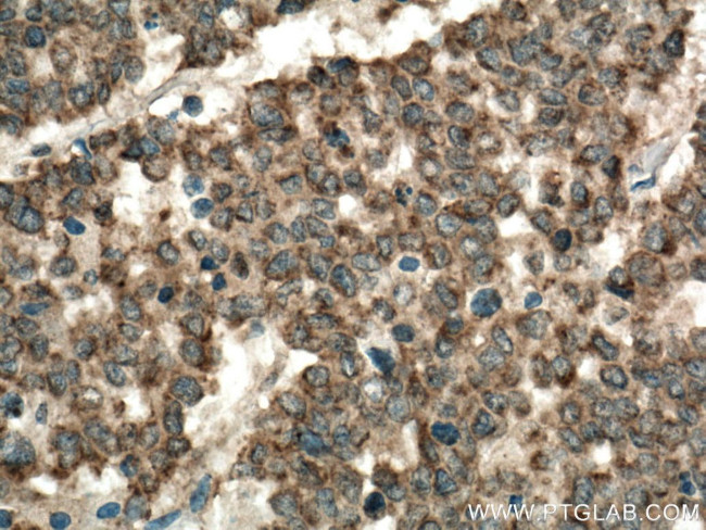 ST6GAL1 Antibody in Immunohistochemistry (Paraffin) (IHC (P))