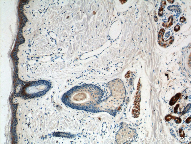 ST6GAL1 Antibody in Immunohistochemistry (Paraffin) (IHC (P))