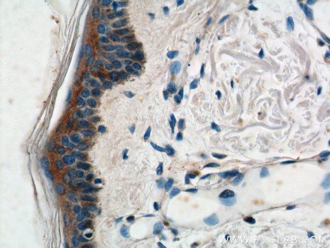 ST6GAL1 Antibody in Immunohistochemistry (Paraffin) (IHC (P))