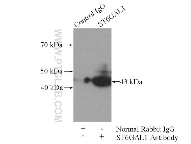 ST6GAL1 Antibody in Immunoprecipitation (IP)