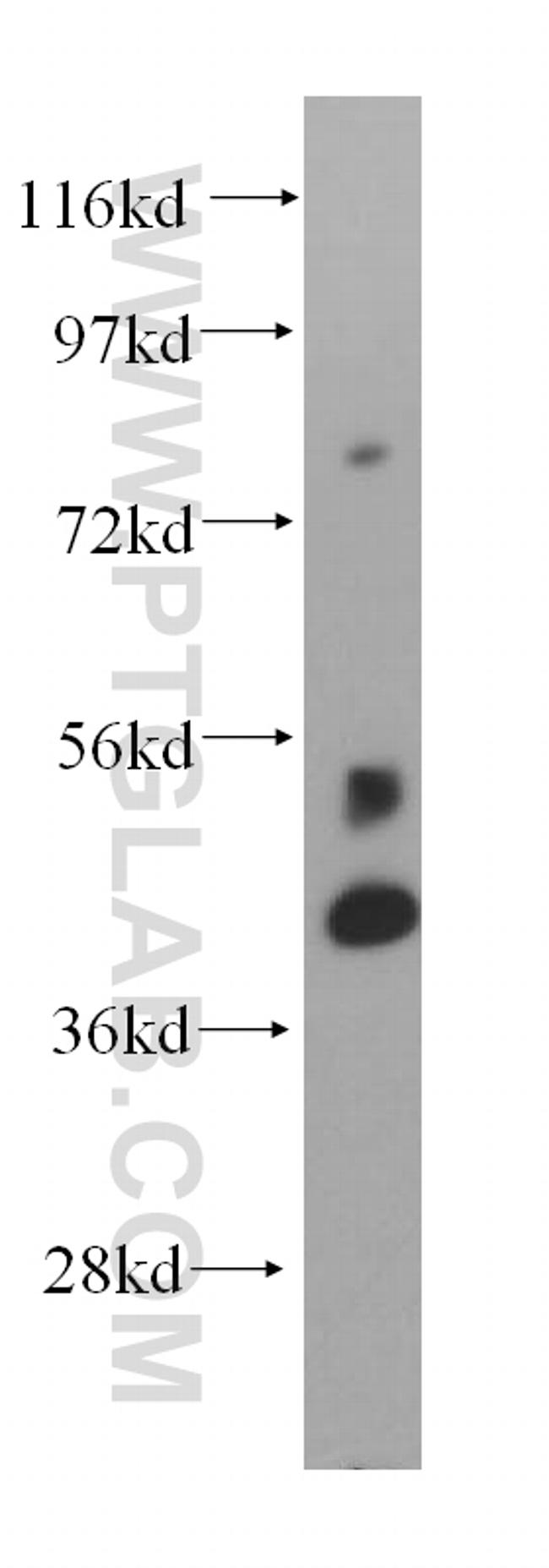 ST6GAL1 Antibody in Western Blot (WB)