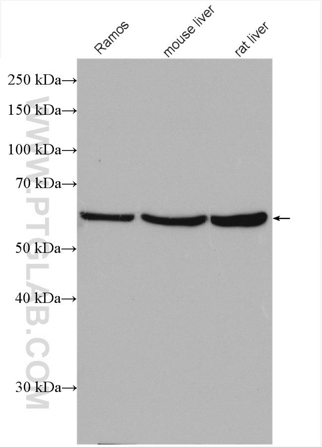 ST6GAL1 Antibody in Western Blot (WB)