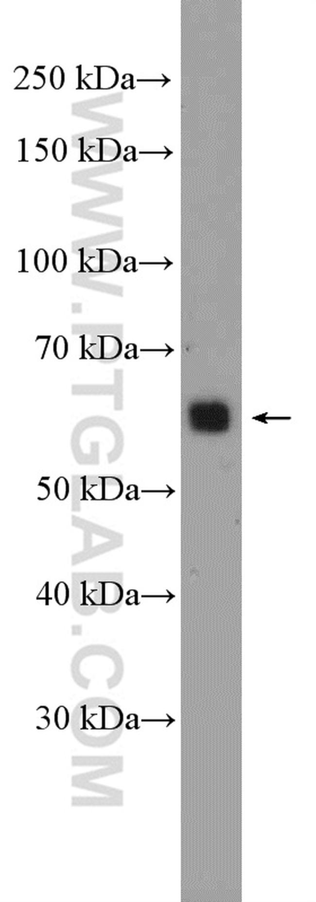 ST6GAL1 Antibody in Western Blot (WB)