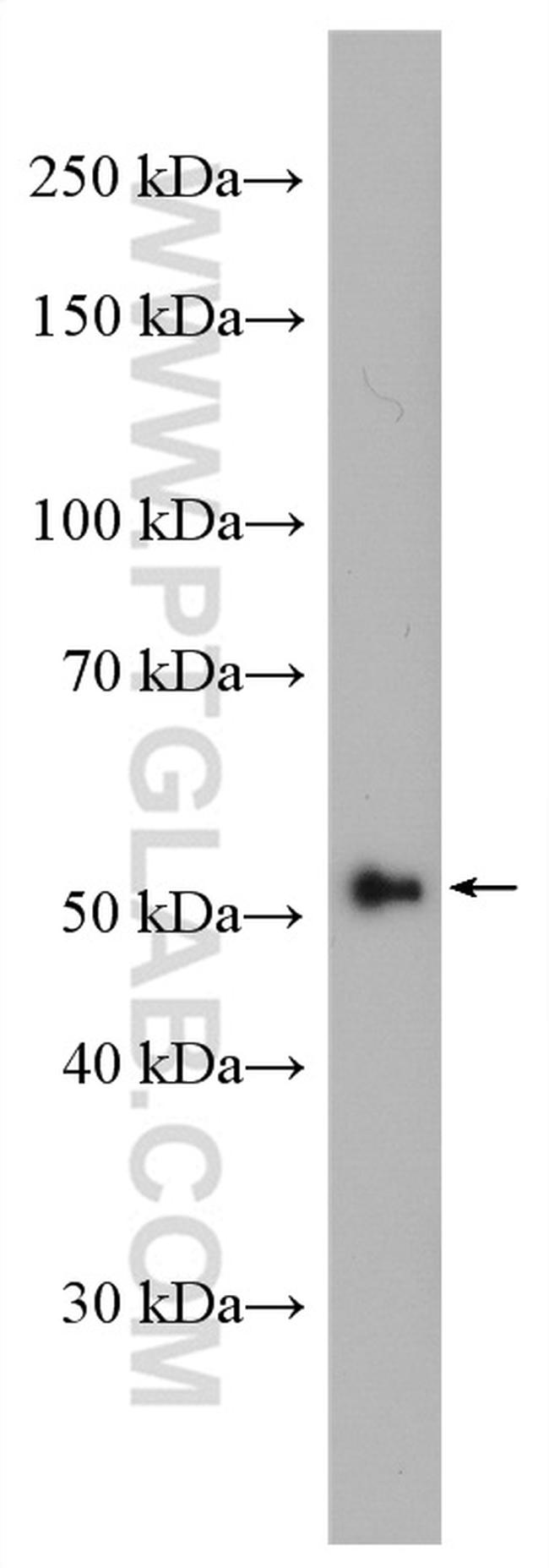 ST6GAL1 Antibody in Western Blot (WB)