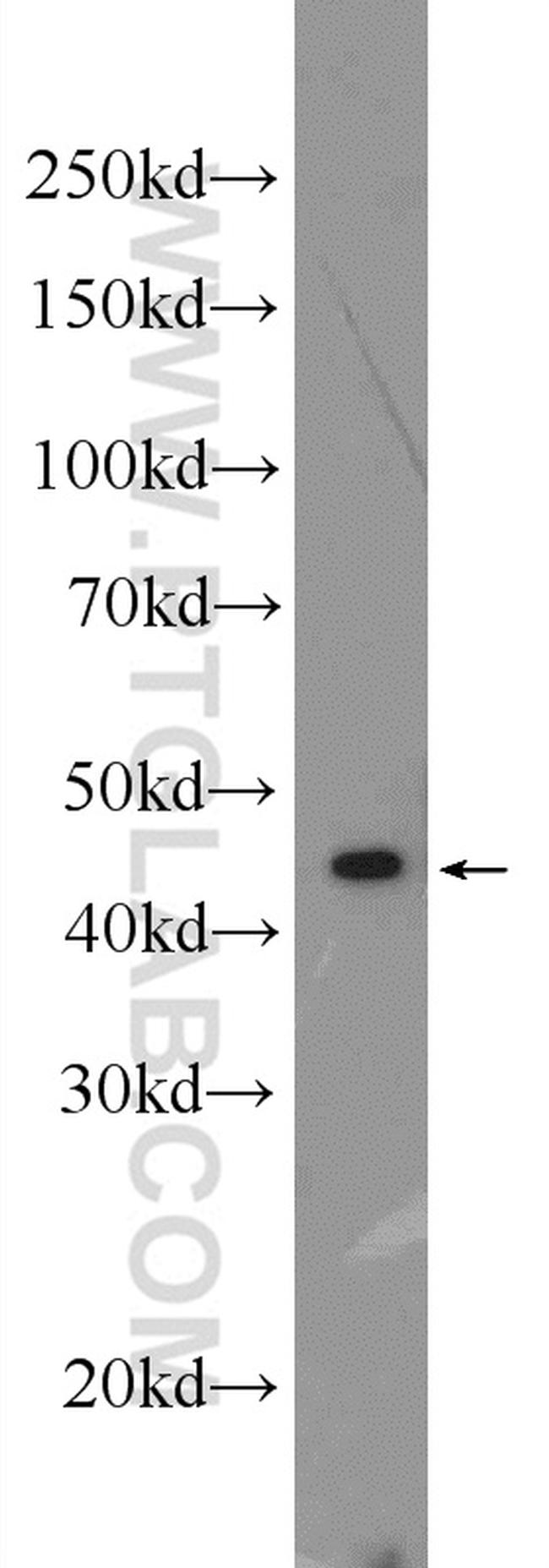 ST6GAL1 Antibody in Western Blot (WB)