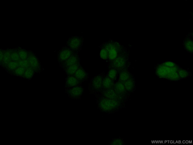 ERG Antibody in Immunocytochemistry (ICC/IF)