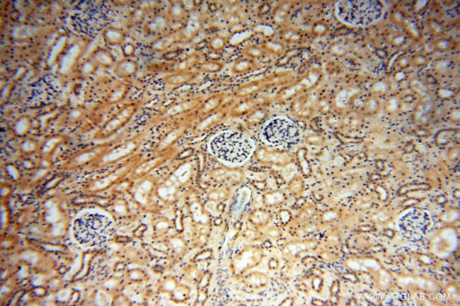 ERG Antibody in Immunohistochemistry (Paraffin) (IHC (P))