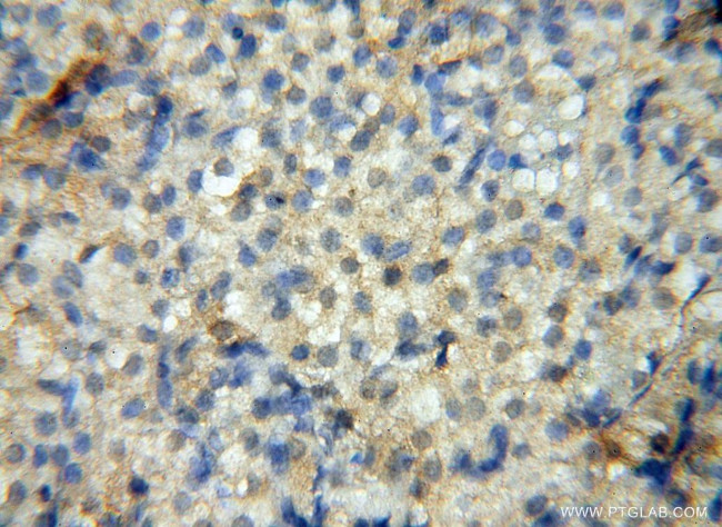 ERG Antibody in Immunohistochemistry (Paraffin) (IHC (P))