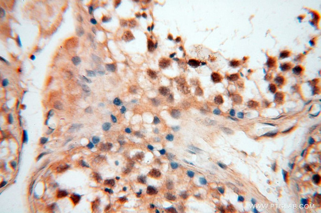 ERG Antibody in Immunohistochemistry (Paraffin) (IHC (P))