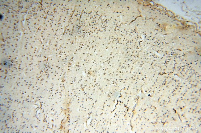 ERG Antibody in Immunohistochemistry (Paraffin) (IHC (P))