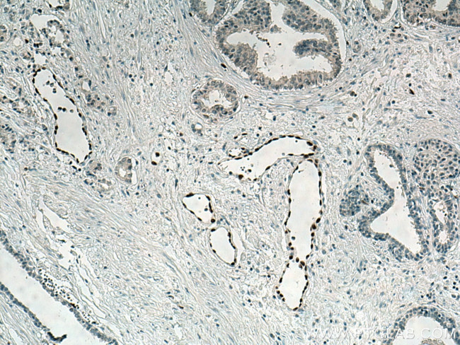 ERG Antibody in Immunohistochemistry (Paraffin) (IHC (P))