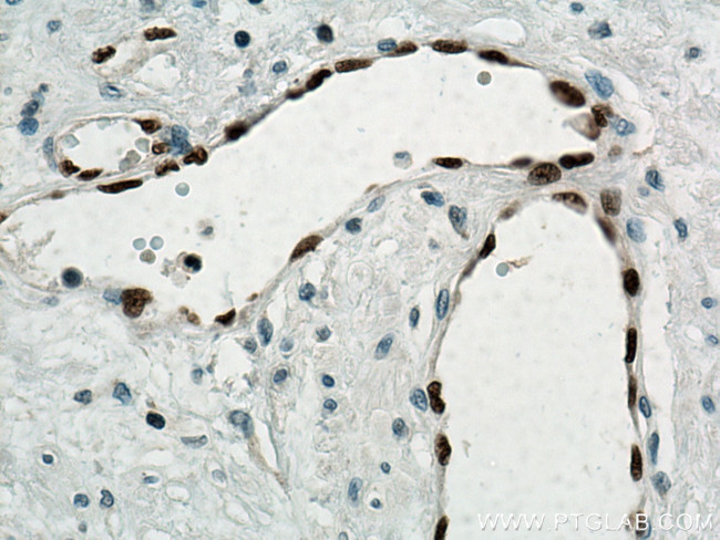 ERG Antibody in Immunohistochemistry (Paraffin) (IHC (P))