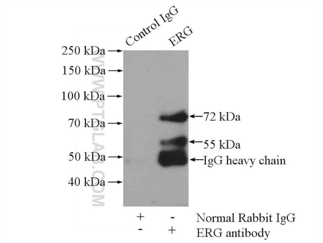 ERG Antibody in Immunoprecipitation (IP)