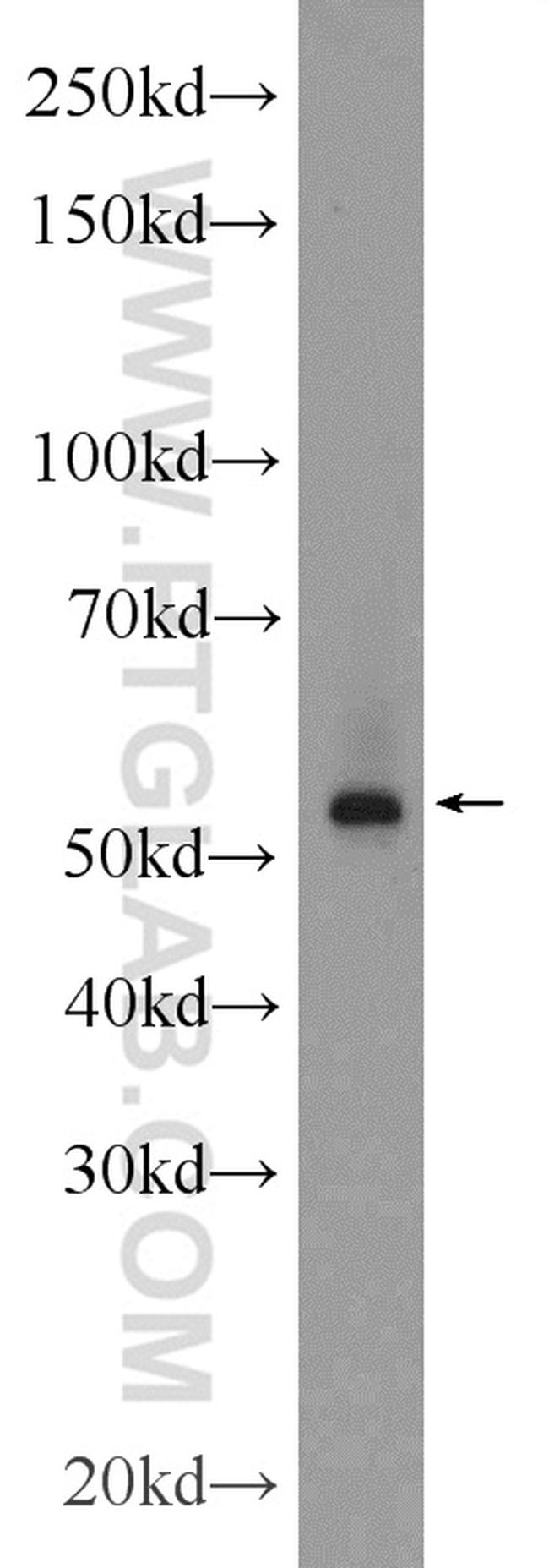 ERG Antibody in Western Blot (WB)