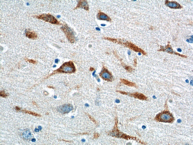 PTGER3 Antibody in Immunohistochemistry (Paraffin) (IHC (P))