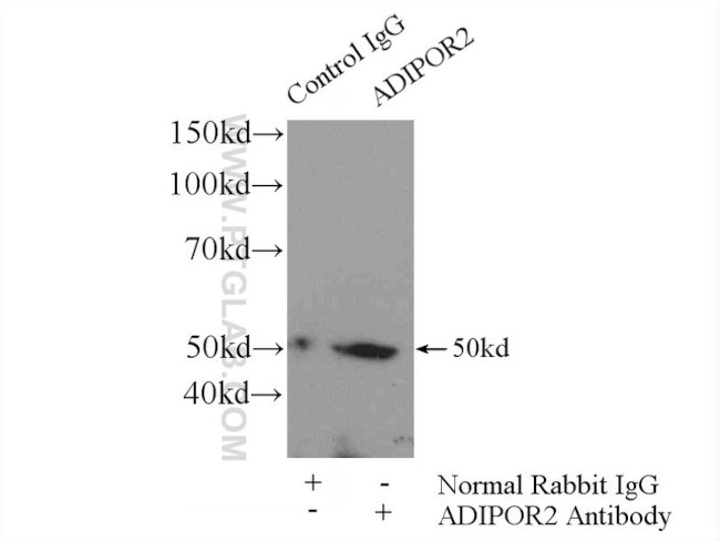 Adiponectin receptor Antibody in Immunoprecipitation (IP)