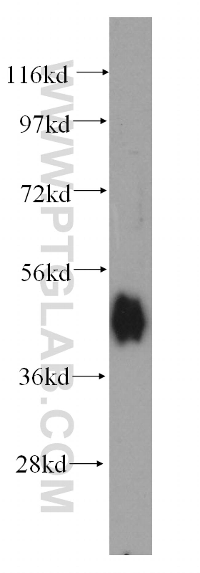 Adiponectin receptor Antibody in Western Blot (WB)