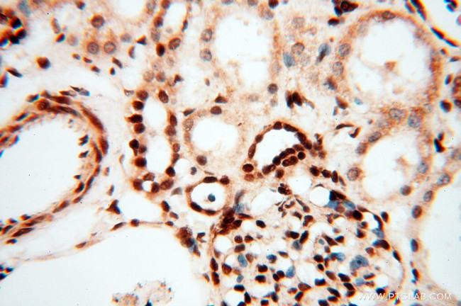 RBM3 Antibody in Immunohistochemistry (Paraffin) (IHC (P))