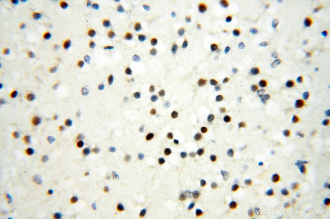 RBM3 Antibody in Immunohistochemistry (Paraffin) (IHC (P))