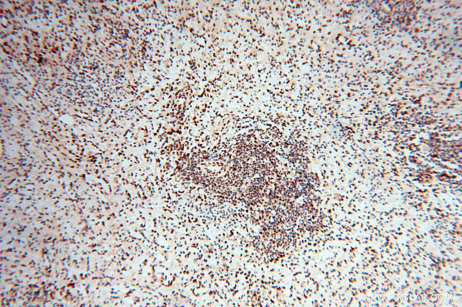 RBM3 Antibody in Immunohistochemistry (Paraffin) (IHC (P))