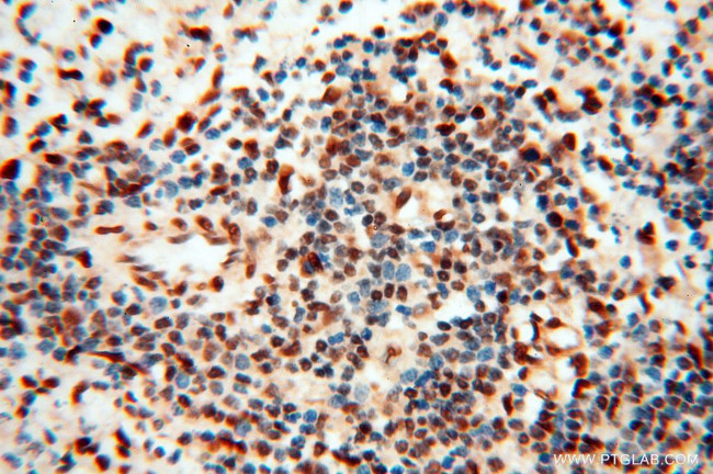 RBM3 Antibody in Immunohistochemistry (Paraffin) (IHC (P))