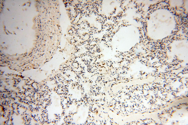 RBM3 Antibody in Immunohistochemistry (Paraffin) (IHC (P))