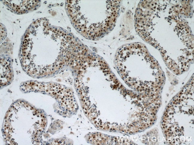 RBM3 Antibody in Immunohistochemistry (Paraffin) (IHC (P))