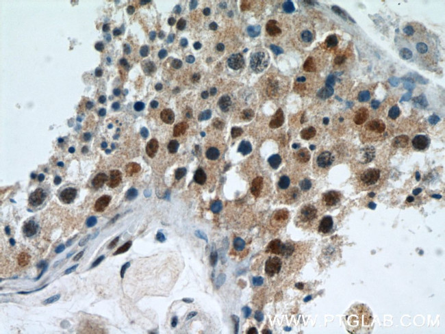 RBM3 Antibody in Immunohistochemistry (Paraffin) (IHC (P))