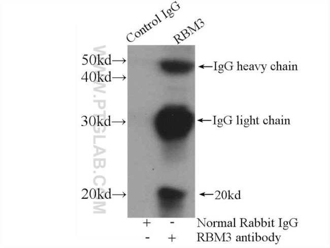 RBM3 Antibody in Immunoprecipitation (IP)