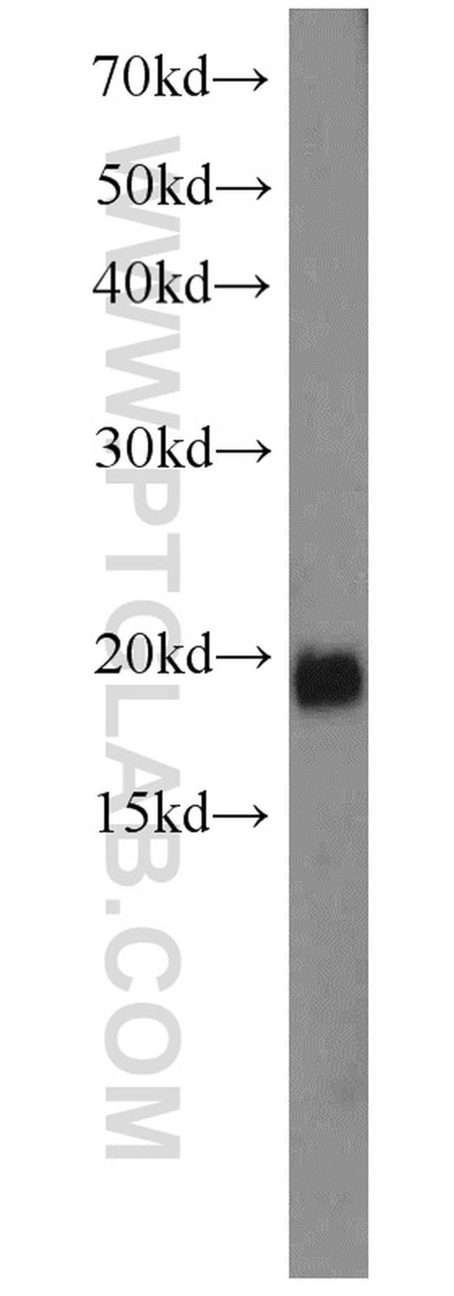 RBM3 Antibody in Western Blot (WB)