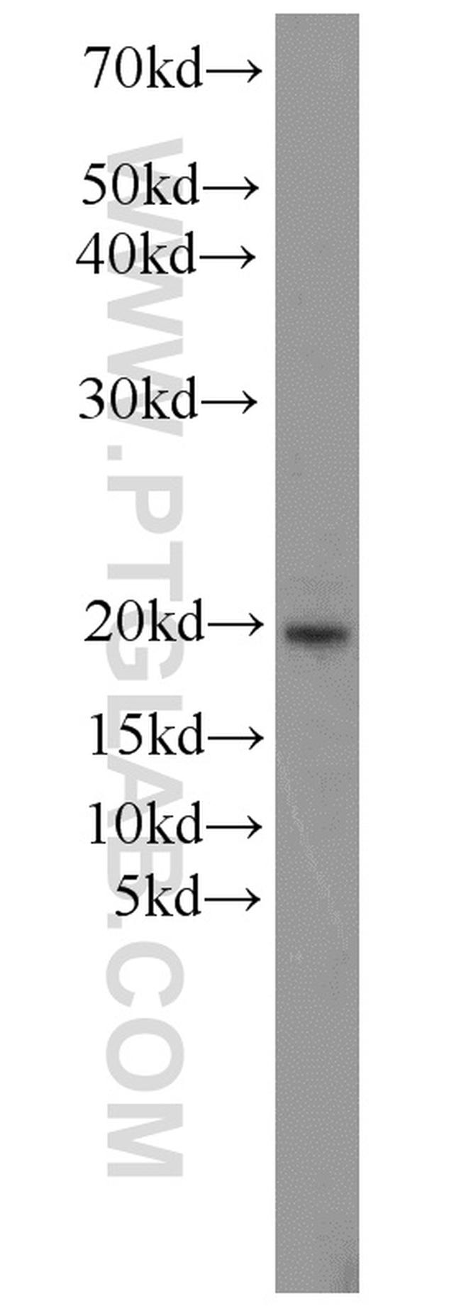 RBM3 Antibody in Western Blot (WB)