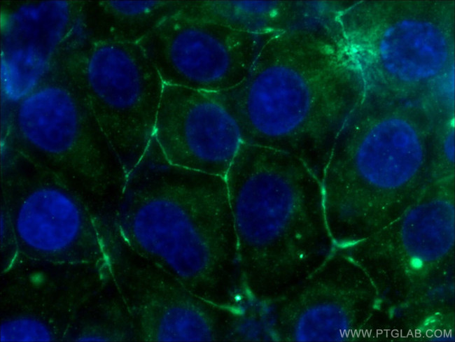 PKC gamma Antibody in Immunocytochemistry (ICC/IF)