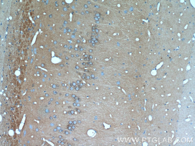 PKC gamma Antibody in Immunohistochemistry (Paraffin) (IHC (P))