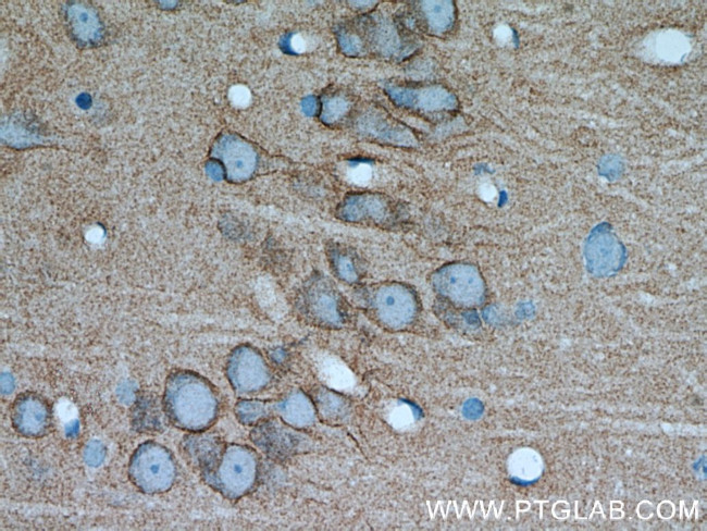 PKC gamma Antibody in Immunohistochemistry (Paraffin) (IHC (P))