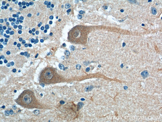 PKC gamma Antibody in Immunohistochemistry (Paraffin) (IHC (P))