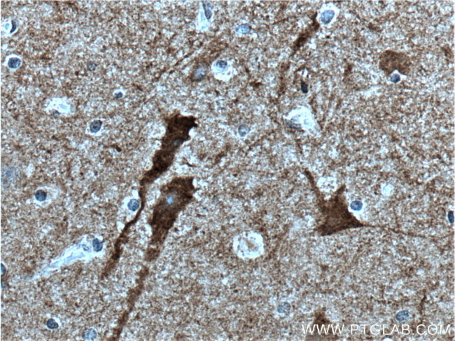 PKC gamma Antibody in Immunohistochemistry (Paraffin) (IHC (P))