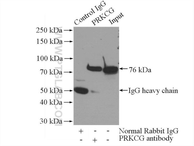 PKC gamma Antibody in Immunoprecipitation (IP)