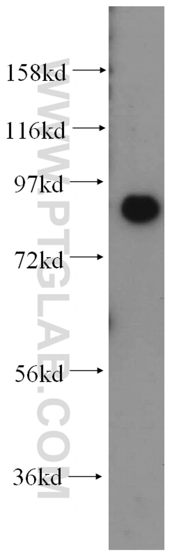 VAP1 Antibody in Western Blot (WB)