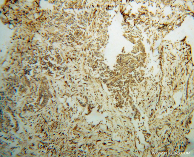 FAM175A Antibody in Immunohistochemistry (Paraffin) (IHC (P))