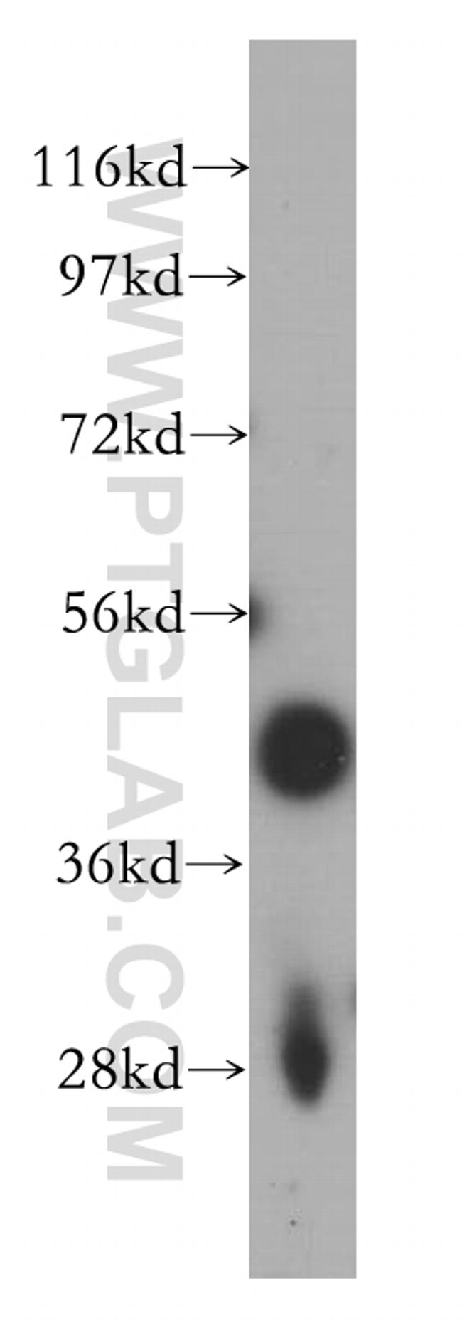 FAM175A Antibody in Western Blot (WB)