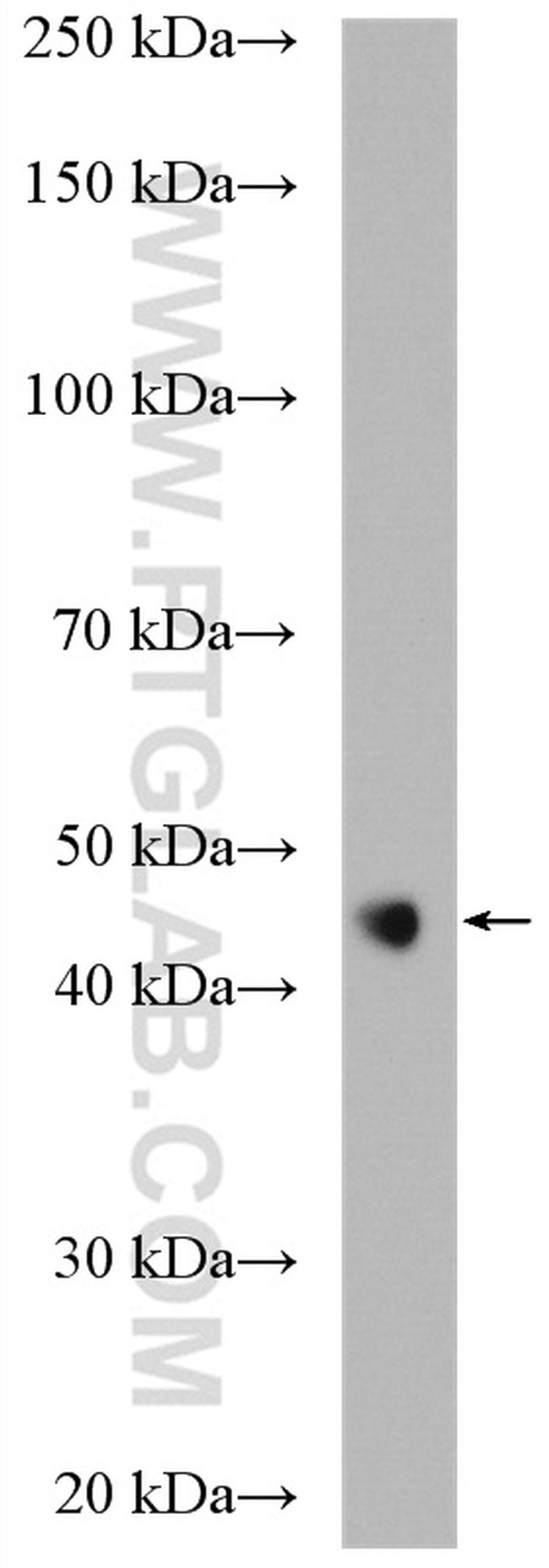 FAM175A Antibody in Western Blot (WB)